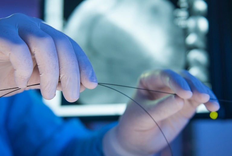 Angioplasty Drug Eluting Stent (DES) or Drug Coated Balloon (DCB)