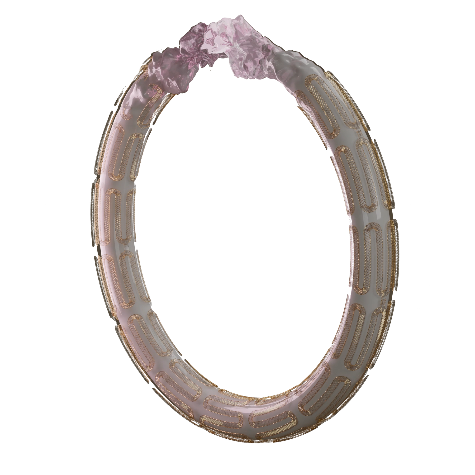 Fusion Coating – Drug Eluting Stent Fusion Coating - Drug Eluting Stent